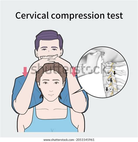 cervical compression constitute objective test serious injury|pathophysiology of cervical injuries.